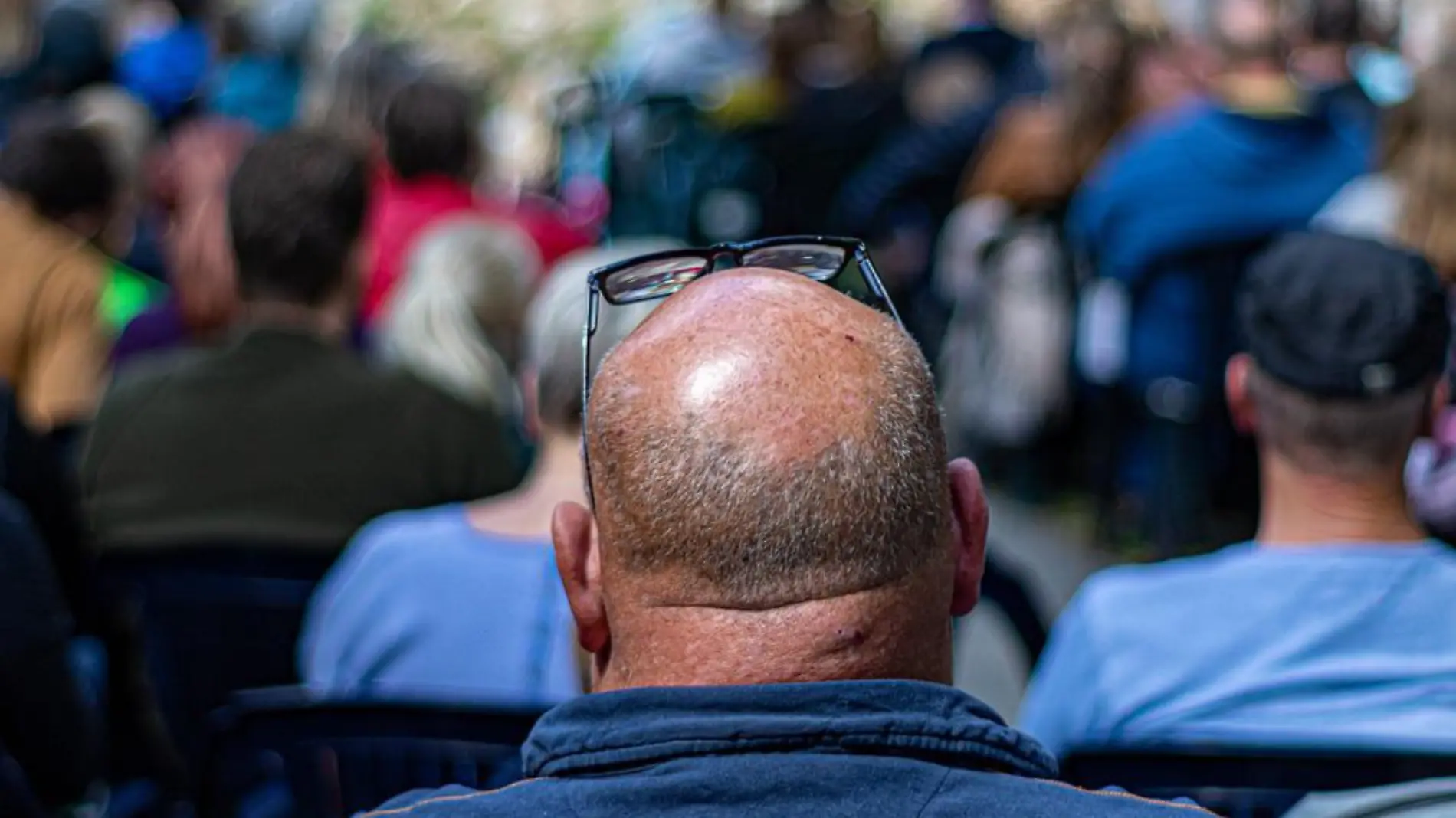 Adiós a las entradas esto sabemos de la píldora contra la calvicie aprobada en EU